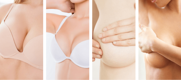 Cirugía de las Mamas I Instituto Tapia